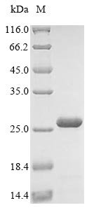 Recombinant Zaire ebolavirus RNA-directed RNA polymerase L (L), partial, Zaire ebolavirus (strain Mayinga-76) (ZEBOV) (Zaire Ebola virus), E.coli, N-terminal 6xHis-tagged, 24.9kDa, purity >85% as determined by SDS-PAGE.
