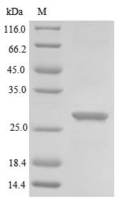 Recombinant Zaire ebolavirus RNA-directed RNA polymerase L (L), partial, Zaire ebolavirus (strain Mayinga-76) (ZEBOV) (Zaire Ebola virus), E.coli, N-terminal 10xHis-tagged and C-terminal Myc-tagged, 27.9kDa, purity >85% as determined by SDS-PAGE.