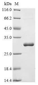 Recombinant Lake Victoria marburgvirus RNA-directed RNA polymerase L (L), partial