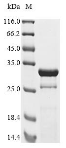 Recombinant Human adenovirus B serotype 3 Hexon protein (L3), partial