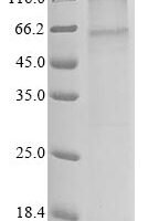 (Tris-Glycine gel) Discontinuous SDS-PAGE (reduced) with 5% enrichment gel and 15% separation gel.