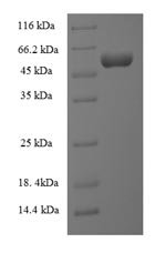 Recombinant Escherichia coli Lipopolysaccharide assembly protein B (lapB), partial, Escherichia coli (strain K12), E.coli, N-terminal 6xHis-SUMO-tagged, 58.8kDa, purity >90% as determined by SDS-PAGE.