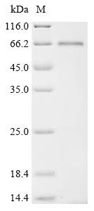 Recombinant Gorilla gorilla gorilla Tyrosine-protein kinase (LCK) (C378S)