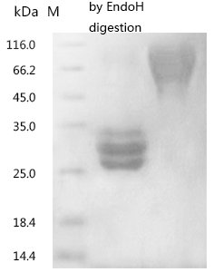Recombinant Rat Leukemia inhibitory factor (Lif)