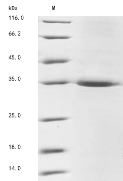 Recombinant Mouse LIM and senescent cell antigen-like-containing domain protein 1 (Lims1)
