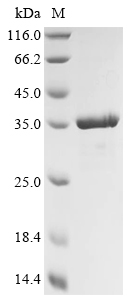 Recombinant Mannheimia haemolytica Leukotoxin (lktA), partial, Mannheimia haemolytica (Pasteurella haemolytica), E.coli, N-terminal 10xHis-tagged and C-terminal Myc-tagged, 33.9kDa, purity >90% as determined by SDS-PAGE.