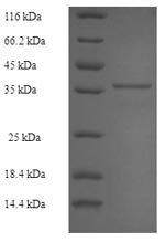 Recombinant Epstein-Barr virus Latent membrane protein 1 (LMP1), partial