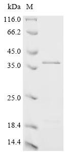 Recombinant Epstein-Barr virus Latent membrane protein 1 (LMP1), partial