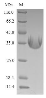 Recombinant Epstein-Barr virus Latent membrane protein 1 (LMP1), partial