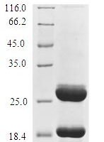 (Tris-Glycine gel) Discontinuous SDS-PAGE (reduced) with 5% enrichment gel and 15% separation gel.