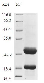 (Tris-Glycine gel) Discontinuous SDS-PAGE (reduced) with 5% enrichment gel and 15% separation gel.