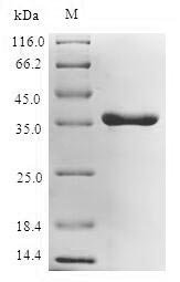 Recombinant Escherichia coli UDP-3-O-acyl-N-acetylglucosamine deacetylase (lpxC), Escherichia coli (strain K12), E.coli, N-terminal 6xHis-tagged, 38.0kDa, purity >90% as determined by SDS-PAGE.