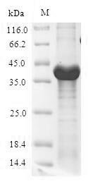 Recombinant Escherichia coli UDP-3-O-acyl-N-acetylglucosamine deacetylase (lpxC), Escherichia coli (strain K12), E.coli, N-terminal 6xHis-SUMO-tagged, 49.8kDa, purity >90% as determined by SDS-PAGE.