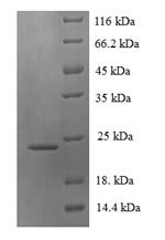Recombinant Pan troglodytes Lymphotoxin-beta (LTB), partial