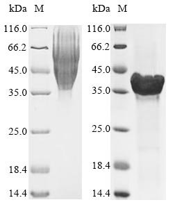 Recombinant Aggregatibacter actinomycetemcomitans Leukotoxin (ltxA), partial, Aggregatibacter actinomycetemcomitans (Actinobacillus actinomycetemcomitans) (Haemophilus actinomycetemcomitans), Yeast, N-terminal 6xHis-tagged, 38.3kDa, purity >85% as determined by SDS-PAGE.