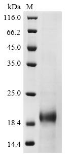 Recombinant Mouse Lymphocyte antigen 6A-2/6E-1 (Ly6a)