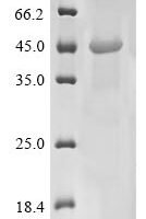 (Tris-Glycine gel) Discontinuous SDS-PAGE (reduced) with 5% enrichment gel and 15% separation gel.