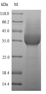 Recombinant Mouse Lymphocyte antigen 6G (Ly6g), partial