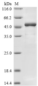 Recombinant Rabies virus Matrix protein (M)