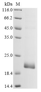 Recombinant Human coronavirus 229E Membrane protein (M), partial