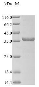 Recombinant Human metapneumovirus Matrix protein (M)