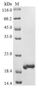 Recombinant Influenza A virus Matrix protein 1 (M1), partial, Influenza A virus, E.coli, N-terminal 10xHis-tagged, 19.3kDa, purity >90% as determined by SDS-PAGE.