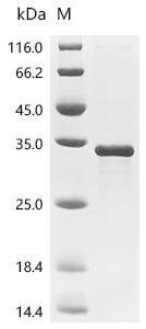Recombinant Mycobacterium tuberculosis Methionine aminopeptidase 1 (map-1), Mycobacterium tuberculosis (strain CDC 1551 / Oshkosh), E.coli, N-terminal 10xHis-tagged, 32.9kDa, purity >90% as determined by SDS-PAGE.