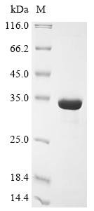 Recombinant Mouse Microtubule-associated protein 1S (Map1s), partial