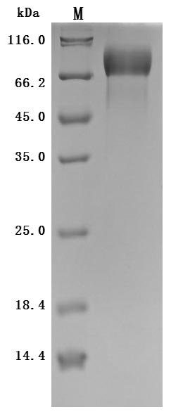 Recombinant Macaca mulatta Microtubule-associated protein tau (MAPT) (Active)
