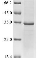 (Tris-Glycine gel) Discontinuous SDS-PAGE (reduced) with 5% enrichment gel and 15% separation gel.