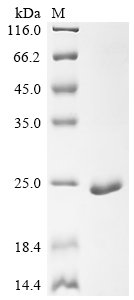 Recombinant Dog Myoglobin (MB), Canis lupus familiaris (Dog) (Canis familiaris), E.coli, N-terminal 6xHis-tagged, 21.3kDa, purity >90% as determined by SDS-PAGE.