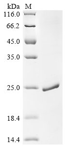 Recombinant Pig Myoglobin (MB), Sus scrofa (Pig), E.coli, N-terminal 6xHis-tagged, 21.0kDa, purity >90% as determined by SDS-PAGE.