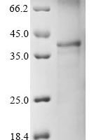 (Tris-Glycine gel) Discontinuous SDS-PAGE (reduced) with 5% enrichment gel and 15% separation gel.