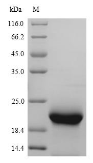 Recombinant Mouse Myoglobin (Mb), Mus musculus (Mouse), Yeast, N-terminal 6xHis-tagged and C-terminal Myc-tagged, 18.9kDa, purity >90% as determined by SDS-PAGE.
