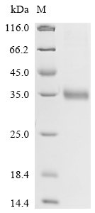 Recombinant Rat Mannose-binding protein C (Mbl2), Rattus norvegicus (Rat), E.coli, N-terminal 6xHis-tagged, 30.0kDa, purity >90% as determined by SDS-PAGE.
