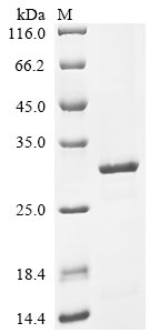 Recombinant Human cytomegalovirus Major capsid protein (MCP), partial