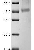 (Tris-Glycine gel) Discontinuous SDS-PAGE (reduced) with 5% enrichment gel and 15% separation gel.