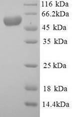 Recombinant Mouse E3 ubiquitin-protein ligase Mdm2 (Mdm2)