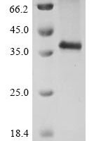 (Tris-Glycine gel) Discontinuous SDS-PAGE (reduced) with 5% enrichment gel and 15% separation gel.