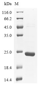 Recombinant Mouse Myelin-oligodendrocyte glycoprotein (Mog), partial