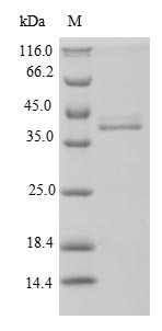 Recombinant Neisseria meningitidis serogroup B Penicillin-binding protein 1A (mrcA), partial