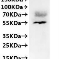 CSB-MP854119HU is detected by Mouse anti-6*His monoclonal antibody
