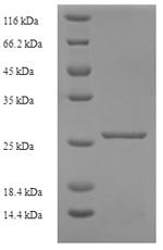 Recombinant Mouse Murinoglobulin-1 (Mug1), partial, Mus musculus (Mouse), E.coli, N-terminal 6xHis-tagged, 27.0kDa, purity >90% as determined by SDS-PAGE.