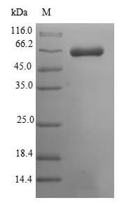 Recombinant Mouse Muscle, skeletal receptor tyrosine-protein kinase (Musk), partial