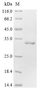Recombinant Bovine Myosin light chain 3 (MYL3)