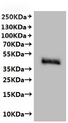 Recombinant Human Stearoyl-CoA desaturase (SCD)-VLPs Protein, Homo sapiens (Human), Mammalian cell, C-terminal 10xHis-tagged, 42.9kDa, purity >The purity information is not available for VLPs proteins.