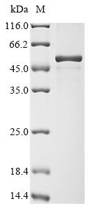 Recombinant Human coronavirus NL63 Nucleoprotein (N)