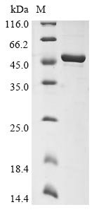 Recombinant Human coronavirus 229E Nucleoprotein (N)