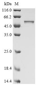 Recombinant Severe acute respiratory syndrome coronavirus 2 Nucleoprotein (N) (D3L,R203K,G204R,S235F) (Active)