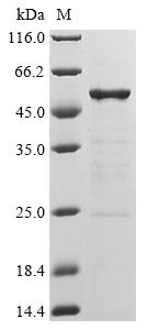 Recombinant Severe acute respiratory syndrome coronavirus 2 Nucleoprotein (N) (Q384H) (Active)